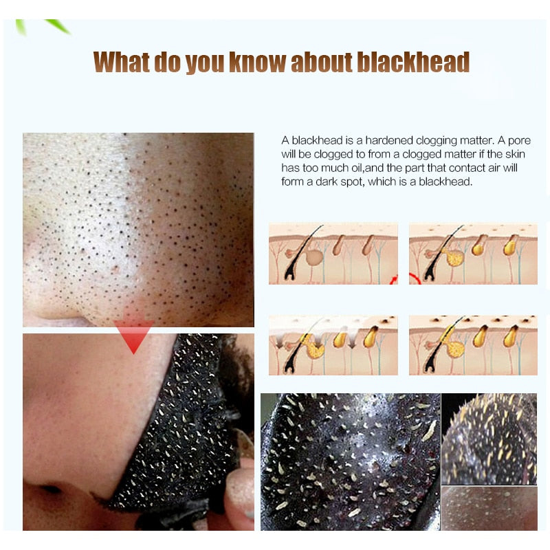 Luxury black head remover face mask