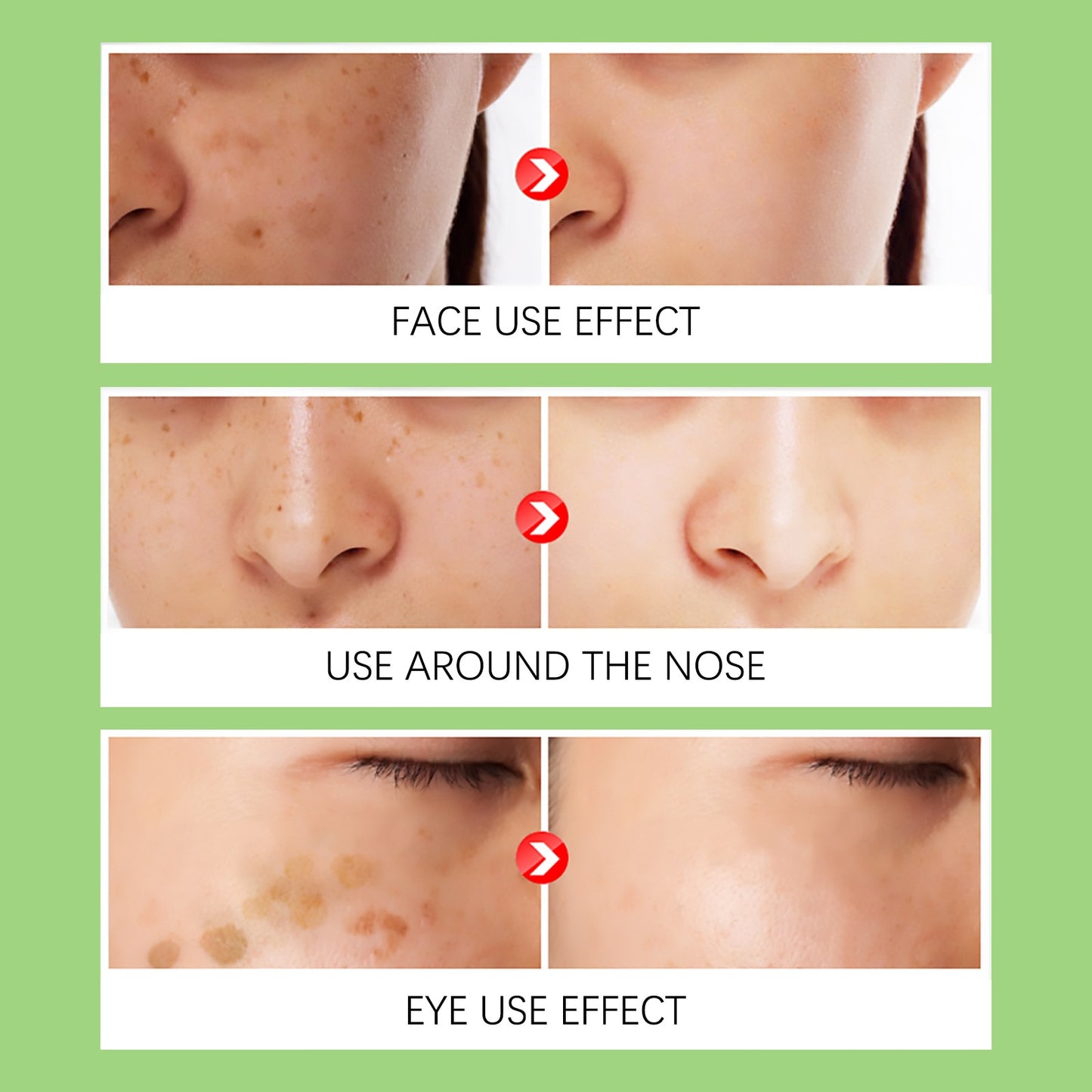 Whitening Melanin Brightening / Anti-Ageing Cream